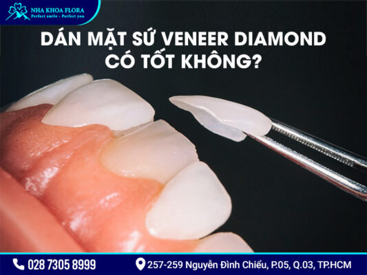 Mặt dán sứ Diamond - ảnh 2 Mặt dán sứ Diamond - ảnh 2