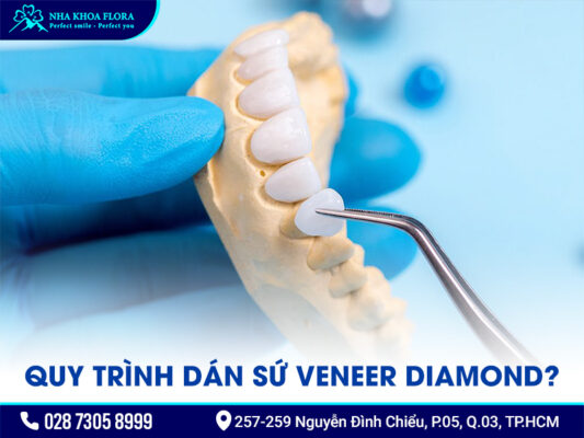 Mặt dán sứ Diamond - ảnh 4 Mặt dán sứ Diamond - ảnh 4