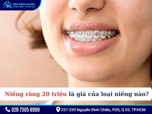 Niềng răng 20 triệu - ảnh 1 Niềng răng 20 triệu - ảnh 1
