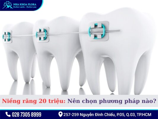 Niềng răng 20 triệu - ảnh 2 Niềng răng 20 triệu - ảnh 2