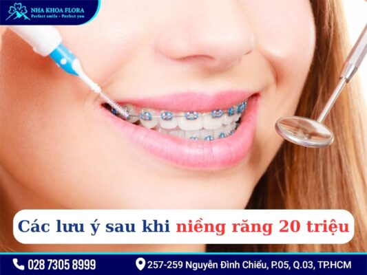 Niềng răng 20 triệu - ảnh 4 Niềng răng 20 triệu - ảnh 4