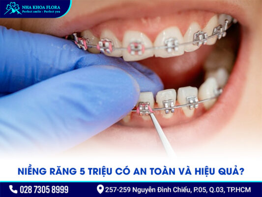 Niềng răng 5 triệu - ảnh 1 Niềng răng 5 triệu - ảnh 1