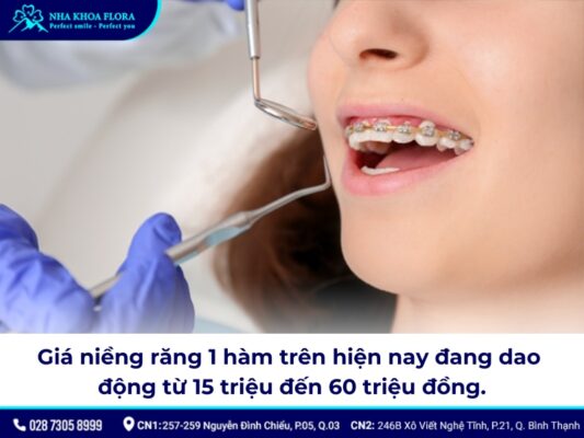 Niềng răng bao nhiêu tiền 1 hàm - ảnh 3 Niềng răng bao nhiêu tiền 1 hàm - ảnh 3