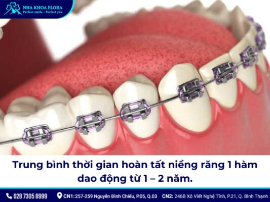 Niềng răng bao nhiêu tiền 1 hàm - ảnh 5 Niềng răng bao nhiêu tiền 1 hàm - ảnh 5