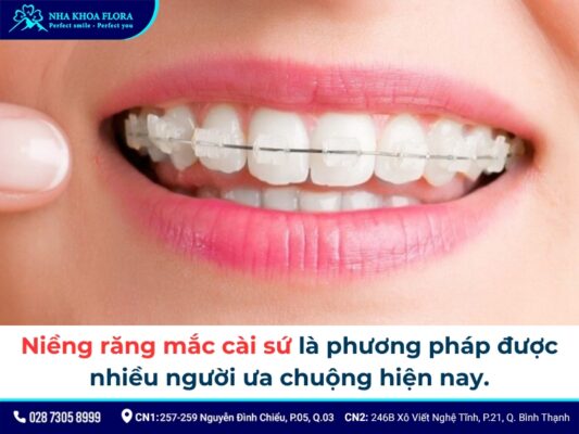 niềng răng cửa - ảnh 3 niềng răng cửa - ảnh 3