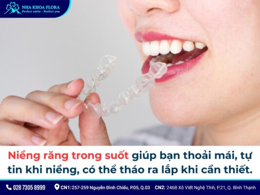 niềng răng cửa - ảnh 4 niềng răng cửa - ảnh 4