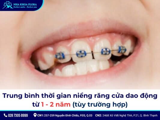 niềng răng cửa - ảnh 5 niềng răng cửa - ảnh 5