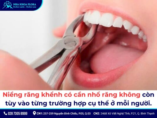 Niềng răng khểnh - ảnh 8 Niềng răng khểnh - ảnh 8