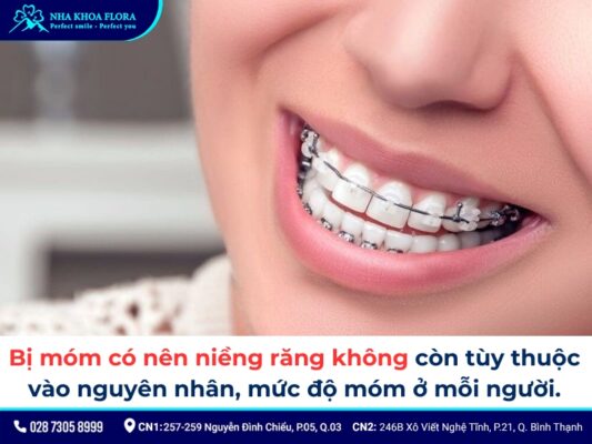 niềng răng móm - ảnh 3 niềng răng móm - ảnh 3