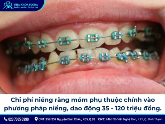 niềng răng móm - ảnh 7 niềng răng móm - ảnh 7