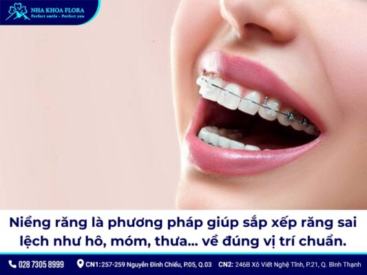 niềng răng người lớn - ảnh 1 niềng răng người lớn - ảnh 1