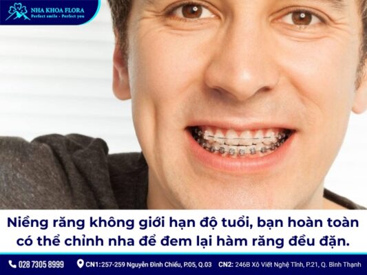 niềng răng người lớn - ảnh 2 niềng răng người lớn - ảnh 2