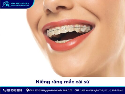 niềng răng người lớn - ảnh 6 niềng răng người lớn - ảnh 6