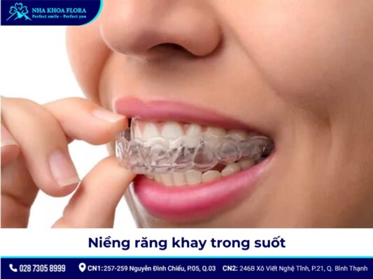 niềng răng người lớn - ảnh 7 niềng răng người lớn - ảnh 7