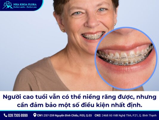 niềng răng người lớn - ảnh 8 niềng răng người lớn - ảnh 8