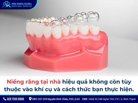 niềng răng tại nhà - ảnh 3 niềng răng tại nhà - ảnh 3