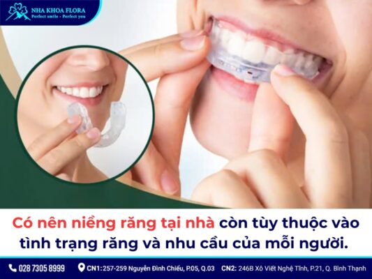 niềng răng tại nhà - ảnh 4 niềng răng tại nhà - ảnh 4