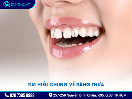 Niềng răng thưa 1 hàm giá bao nhiêu - ảnh 1 Niềng răng thưa 1 hàm giá bao nhiêu - ảnh 1