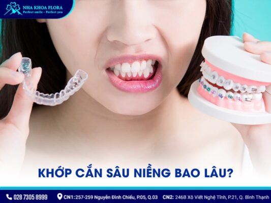 quy trình niềng răng khớp cắn sâu - ảnh 5 quy trình niềng răng khớp cắn sâu - ảnh 5