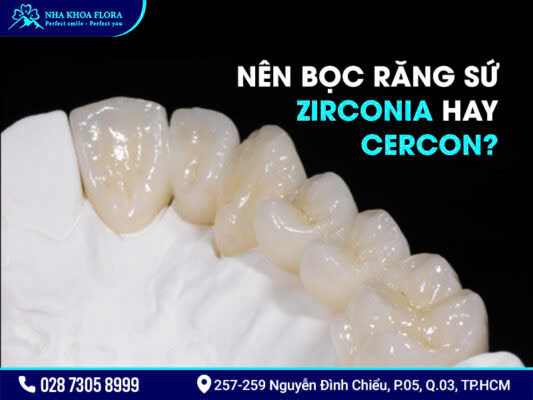 So sánh răng sứ Cercon và Zirconia - ảnh 4 So sánh răng sứ Cercon và Zirconia - ảnh 4