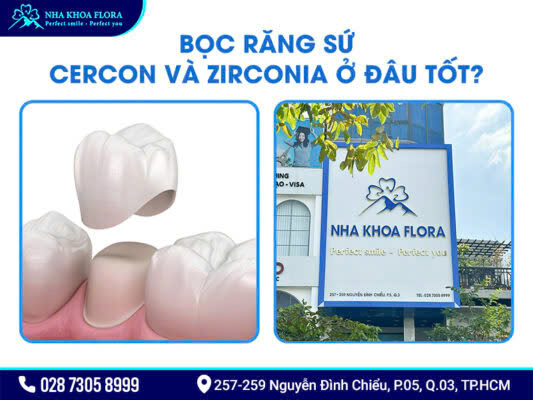 So sánh răng sứ Cercon và Zirconia - ảnh 5 So sánh răng sứ Cercon và Zirconia - ảnh 5