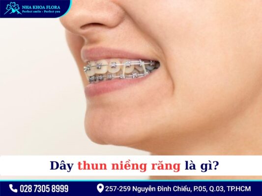 Thun niềng răng - ảnh 1 Thun niềng răng - ảnh 1