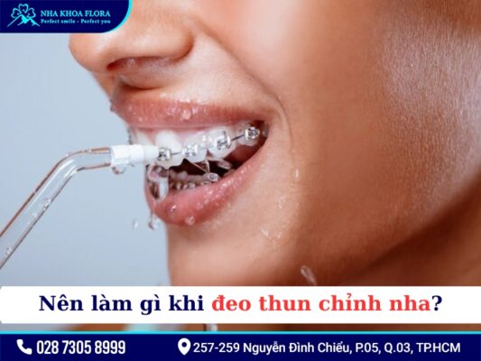 Thun niềng răng - ảnh 3 Thun niềng răng - ảnh 3