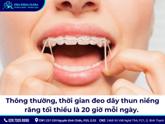 Thun niềng răng - ảnh 4 Thun niềng răng - ảnh 4