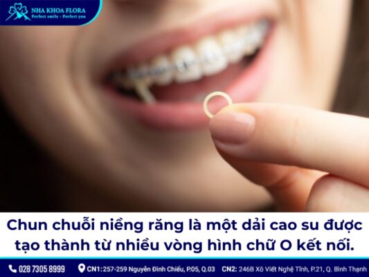 Thun niềng răng - ảnh 5 Thun niềng răng - ảnh 5