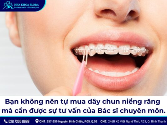 Thun niềng răng - ảnh 7 Thun niềng răng - ảnh 7