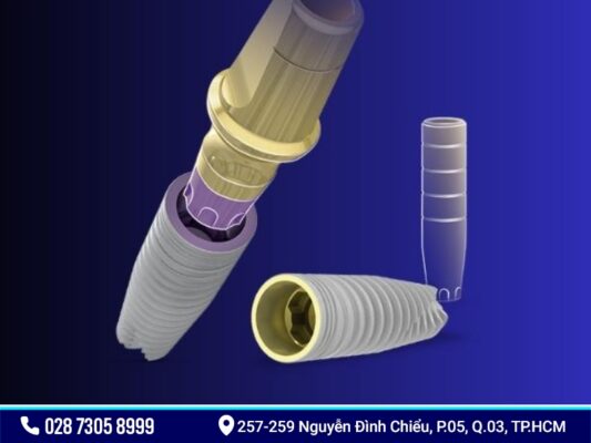 Implant Đức - ảnh 2 Implant Đức - ảnh 2