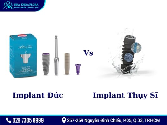 Implant Đức - ảnh 6 Implant Đức - ảnh 6