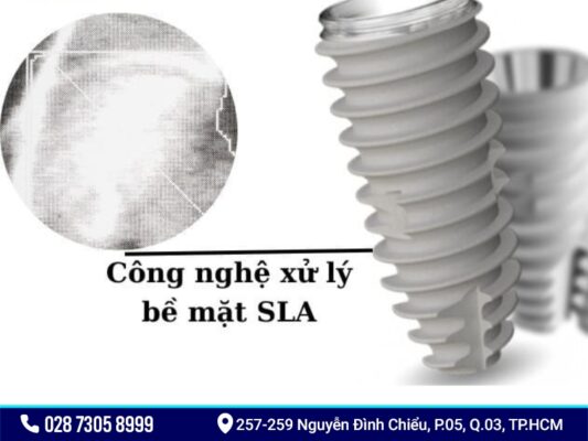 Implant Neobiotech - ảnh 3 Implant Neobiotech - ảnh 3