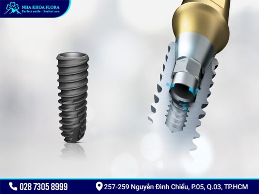 Osstem-implant - ảnh 1 Osstem-implant - ảnh 1