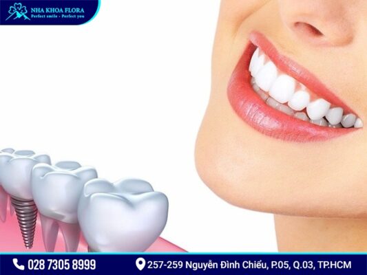 Osstem-implant - ảnh 4 Osstem-implant - ảnh 4
