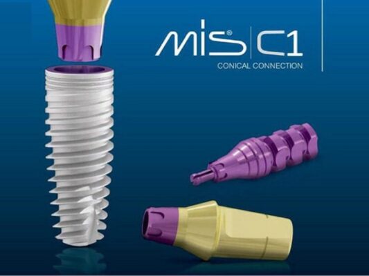 Implant Mis - ảnh 1 Implant Mis - ảnh 1