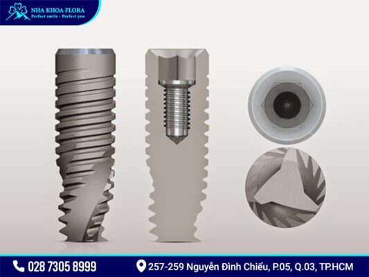 Implant Mis - ảnh 2 Implant Mis - ảnh 2