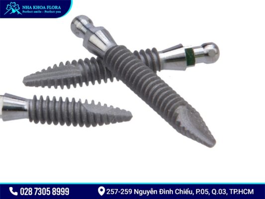 Mini Implant giá bao nhiêu? - ảnh 3 Mini Implant giá bao nhiêu? - ảnh 3