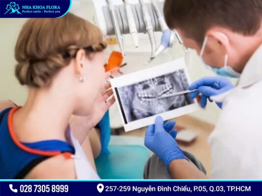 Mini Implant giá bao nhiêu? - ảnh 4 Mini Implant giá bao nhiêu? - ảnh 4