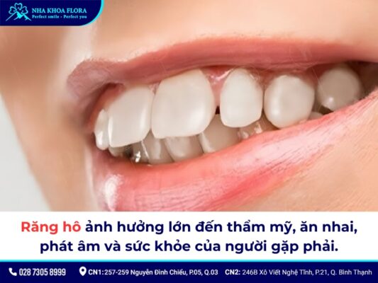 Bọc răng sứ có hết hô không? - ảnh 3 Bọc răng sứ có hết hô không? - ảnh 3