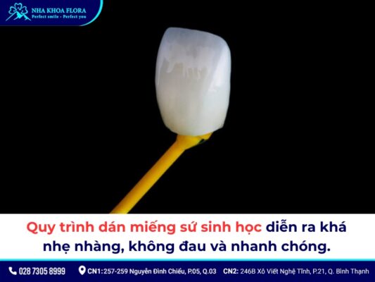 Bọc răng sứ sinh học - ảnh 3 Bọc răng sứ sinh học - ảnh 3