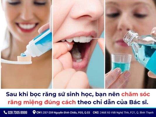 Bọc răng sứ sinh học - ảnh 5 Bọc răng sứ sinh học - ảnh 5