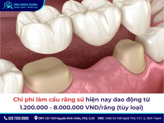 Chi phí làm cầu răng sứ - ảnh 1 Chi phí làm cầu răng sứ - ảnh 1