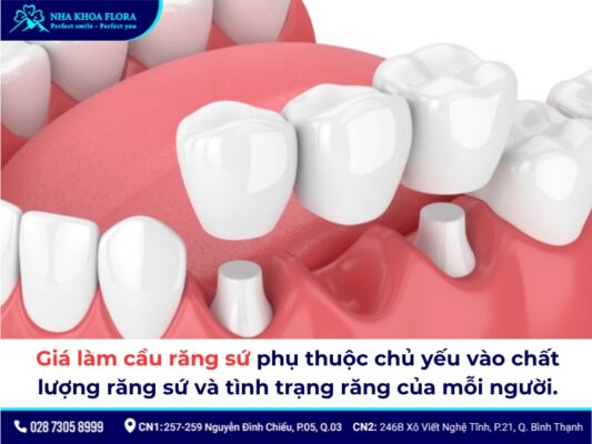 Chi phí làm cầu răng sứ - ảnh 2 Chi phí làm cầu răng sứ - ảnh 2