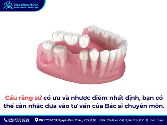 Chi phí làm cầu răng sứ - ảnh 3 Chi phí làm cầu răng sứ - ảnh 3