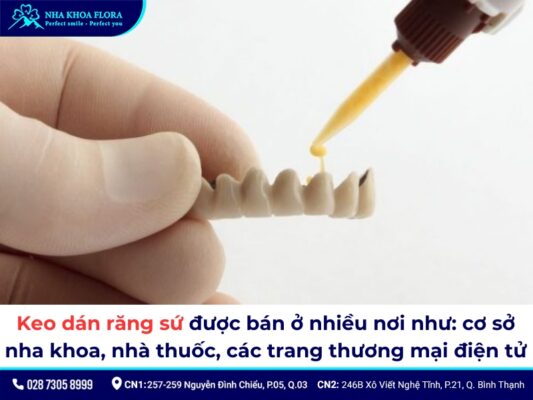 Mua keo dán sứ ở đâu? - ảnh 1 Mua keo dán sứ ở đâu? - ảnh 1
