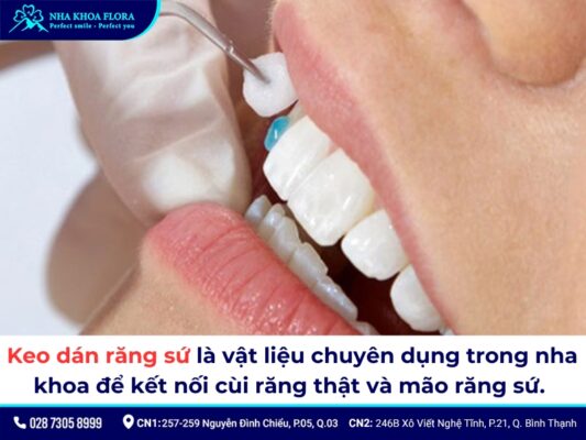 Mua keo dán sứ ở đâu? - ảnh 2 Mua keo dán sứ ở đâu? - ảnh 2