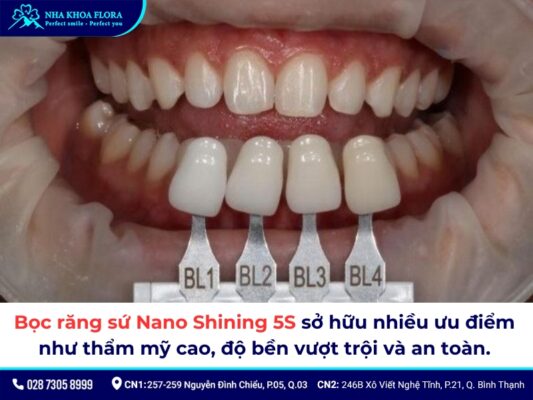 Răng sứ Nano Shining 5S giá bao nhiêu - ảnh 4 Răng sứ Nano Shining 5S giá bao nhiêu - ảnh 4
