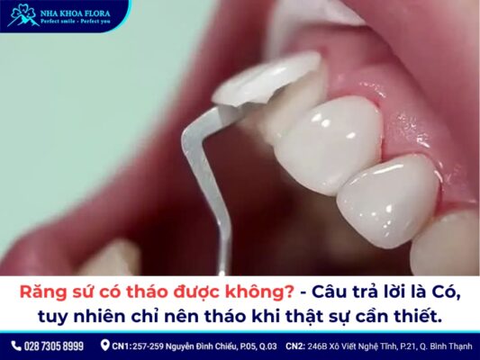 tháo răng sứ có đau không – ảnh 1 tháo răng sứ có đau không – ảnh 1
