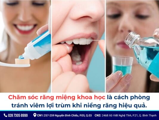 lợi trùm khi niềng răng - ảnh 5 lợi trùm khi niềng răng - ảnh 5